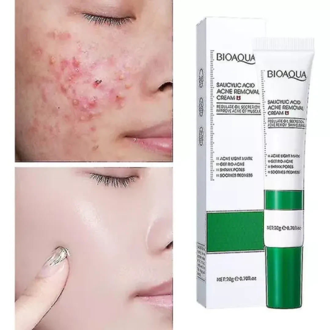 Kit Anti-Acne Poros Abiertos Ácido Salicílico Bioaqua