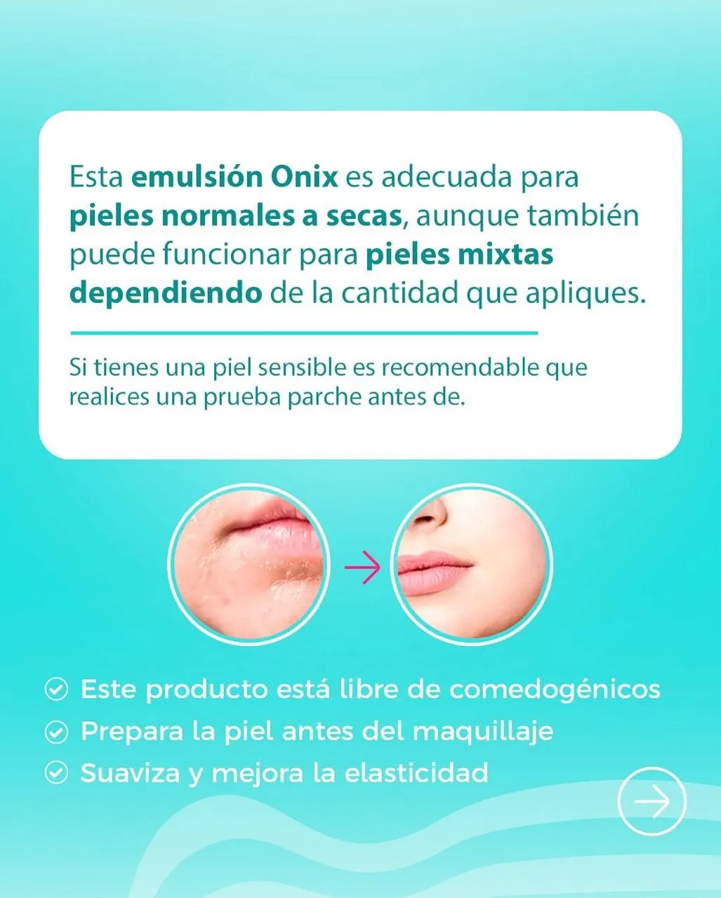 Emulsión Hidratante Facial Linea ONIX