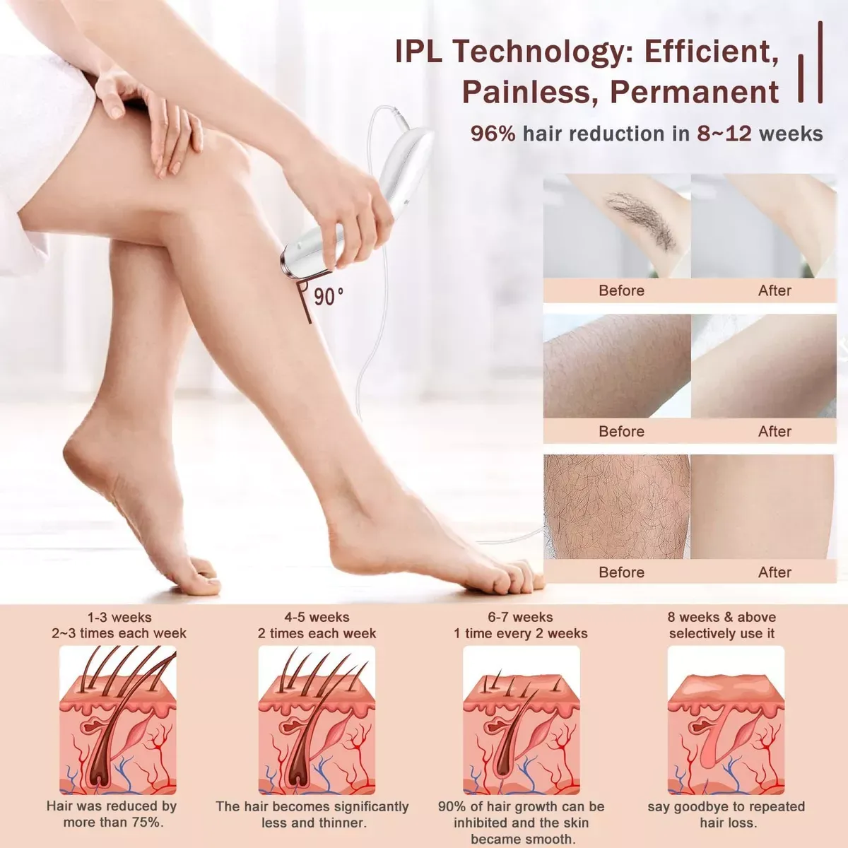 Depiladora Laser Ipl Permanente